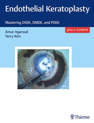 Endothelial Keratoplasty: Mastering Dsek, Dmek, and Pdek by Agarwal, Amar