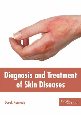 Diagnosis and Treatment of Skin Diseases by Kennedy, Derek