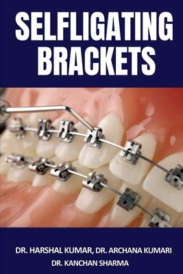 Selfligating Brackets by Harshal