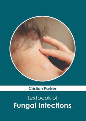 Textbook of Fungal Infections by Parker, Cristian