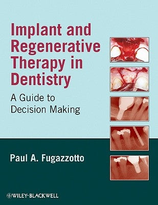 Implant and Regenerative Thera by Fugazzotto, Paul A.