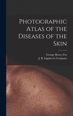 Photographic Atlas of the Diseases of the Skin by Fox, George Henry