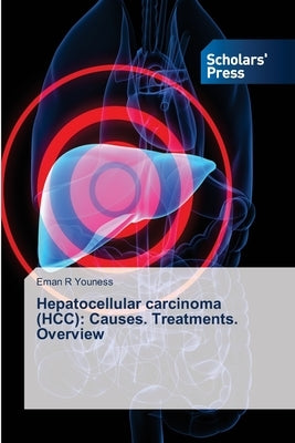 Hepatocellular carcinoma (HCC): Causes. Treatments. Overview by Youness, Eman R.