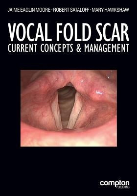 Vocal Fold Scar: Current Concepts and Management by Eaglin Moore, Jaime