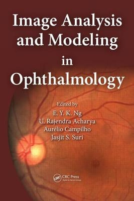 Image Analysis and Modeling in Ophthalmology by Ng, Eddie Y. K.