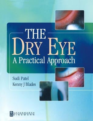 The Dry Eye: A Practical Approach by Patel, Sudi