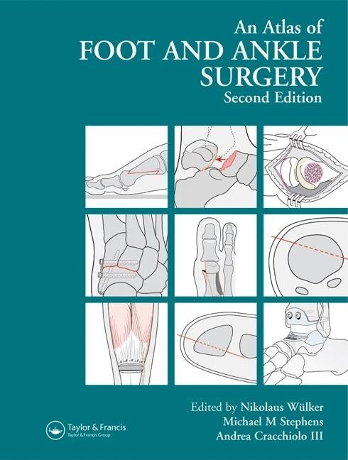 Atlas Foot and Ankle Surgery by Wülker, Nikolaus