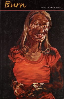 Burn by Vermeersch, Paul