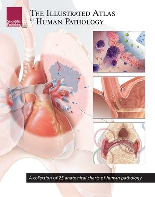 The Illustrated Atlas of Human Pathology: A Collection of 25 Anatomical Charts of Human Pathology by Scientific Publishing