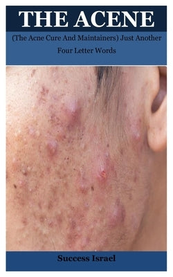 The Acene: (The Acne Cure And Maintainers) Just Another Four Letter Words by Israel, Success