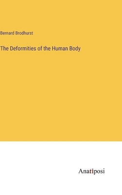 The Deformities of the Human Body by Brodhurst, Bernard