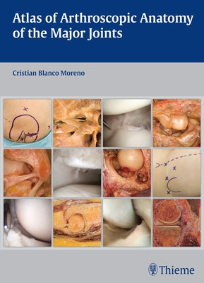Atlas of Arthroscopic Anatomy of the Major Joints by Blanco Moreno, Cristian