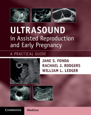Ultrasound in Assisted Reproduction and Early Pregnancy: A Practical Guide by Fonda, Jane S.