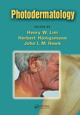 Photodermatology by Lim, Henry W.