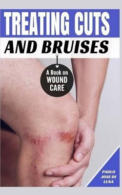 Treating Cuts and Bruises: A Book on Wound Care by Jose De Luna, Paolo