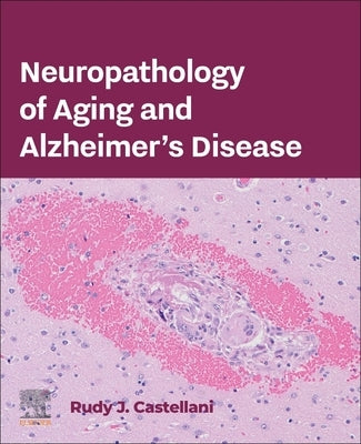 Neuropathology of Aging and Alzheimer's Disease by Castellani, Rudy J.