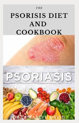 The Psoriasis Diet and Cookbook: Dietary Guide For Preventing and Healing Psoriasis: Includes Delicious Recipe, Meal Plan and Cookbook by David, Dr Elizabeth