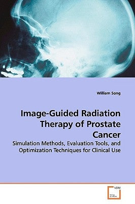Image-Guided Radiation Therapy of Prostate Cancer by Song, William