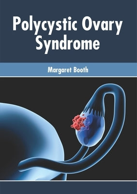 Polycystic Ovary Syndrome by Booth, Margaret