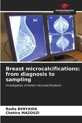 Breast microcalcifications: from diagnosis to sampling by Benyahia, Radia