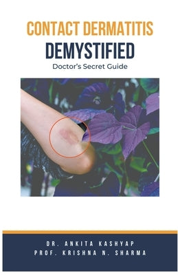 Contact Dermatitis Demystified: Doctor's Secret Guide by Kashyap, Ankita