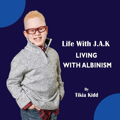 Life With J.A.K Living with Albinism: Living with Albinism by