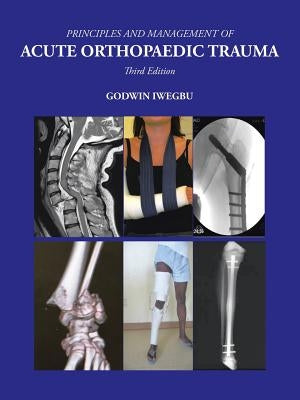 Principles and Management of Acute Orthopaedic Trauma: Third Edition by Iwegbu, Godwin