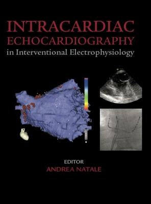 Intracardiac Echocardiography in Interventional Electrophysiology: Advanced Management of Atrial Fibrillation and Ventricular Tachycardia by Natale, Andrea