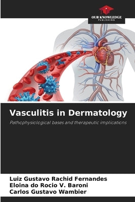 Vasculitis in Dermatology by Rachid Fernandes, Luiz Gustavo