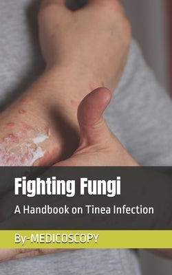 Fighting Fungi: A Handbook on Tinea Infection by Team, Medicoscopy