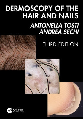 Dermoscopy of the Hair and Nails 3e by Tosti, Antonella