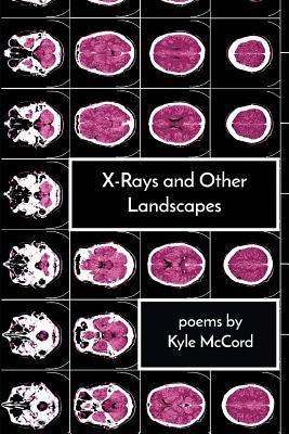 X-Rays and Other Landscapes by McCord, Kyle