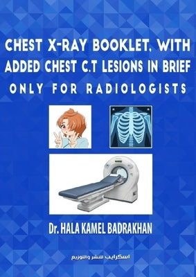 Chest X-Ray Booklet, with added Chest C.T Lesions in brief Only for Radiologists by Badrakhan, Hala Kamel