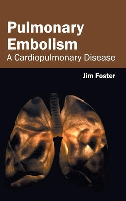 Pulmonary Embolism: A Cardiopulmonary Disease by Foster, Jim