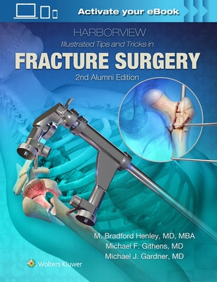 Harborview Illustrated Tips and Tricks in Fracture Surgery by Henley, M.