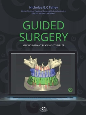 Guided Surgery - Making Implant Placement Simpler by G. C. Fahey Nicholas