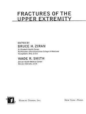 Fractures of the Upper Extremity by Ziran, Bruce H.