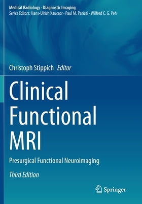 Clinical Functional MRI: Presurgical Functional Neuroimaging by Stippich, Christoph