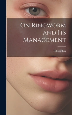 On Ringworm and Its Management by Fox, Tilbury