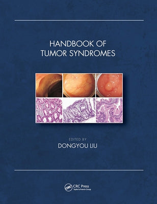 Handbook of Tumor Syndromes by Liu, Dongyou