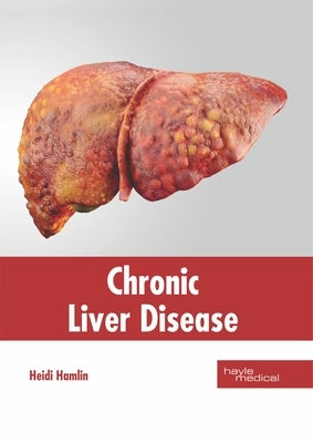 Chronic Liver Disease by Hamlin, Heidi