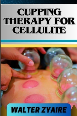 Cupping Therapy for Cellulite: A Complete Guide On Unveiling The Art To Smooth Skin And Cupping Odyssey To Wellness by Zyaire, Walter
