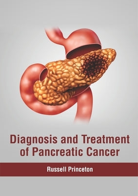 Diagnosis and Treatment of Pancreatic Cancer by Princeton, Russell