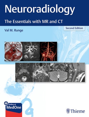 Neuroradiology: The Essentials with MR and CT by Runge, Val M.