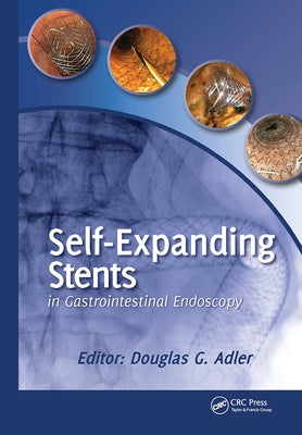 Self-Expanding Stents in Gastrointestinal Endoscopy by Adler, Douglas
