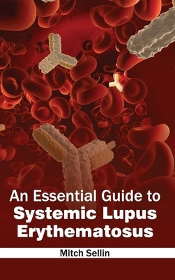 Essential Guide to Systemic Lupus Erythematosus by Sellin, Mitch