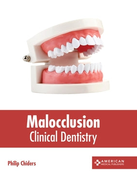 Malocclusion: Clinical Dentistry by Chiders, Philip
