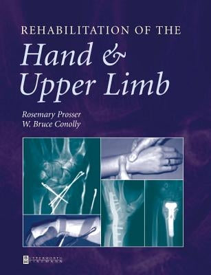 Rehabilitation of the Hand and Upper Limb by Conolly, W. Bruce