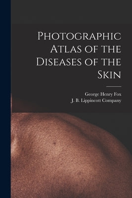 Photographic Atlas of the Diseases of the Skin by Fox, George Henry