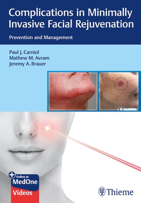 Complications in Minimally Invasive Facial Rejuvenation: Prevention and Management by Carniol, Paul J.